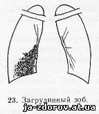 Анализ характеристик парения на флюорограммах