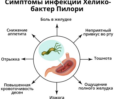 Бактерия хеликобактер пилори и ее воздействие на желудок