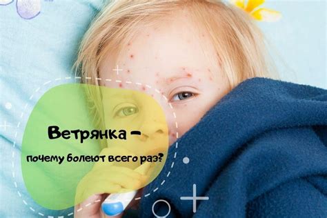 Ветрянка и родители: что нужно знать?