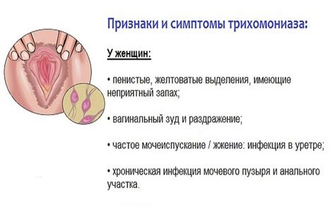 Влияет ли стадия заболевания на болевые ощущения при нажатии