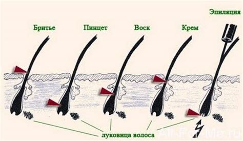 Влияние бритья против роста волос на кожу