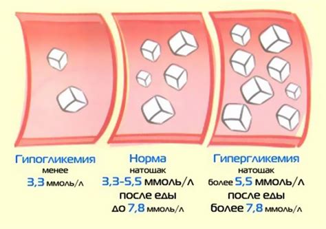 Влияние глюкофажа на снижение уровня сахара в крови