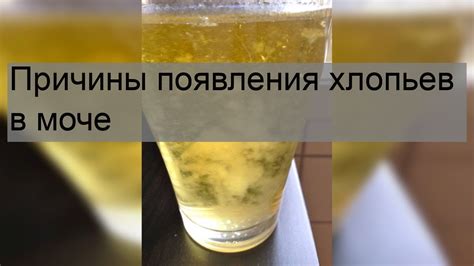 Влияние диеты на образование хлопьев в моче