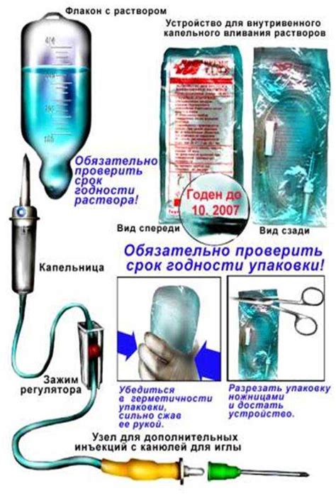 Влияние техники подачи капельницы на появление дует вены