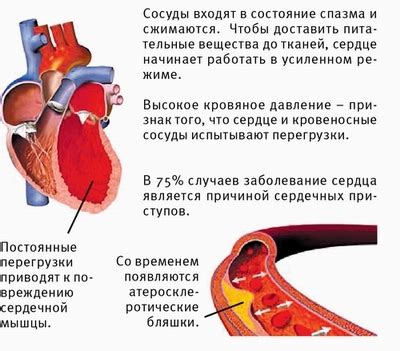 Воздействие отжиманий на сердце и сосуды при повышенном давлении