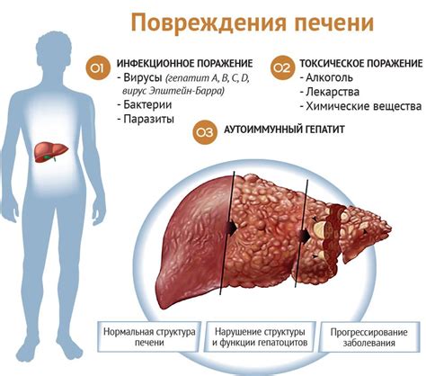 Возможное влияние цикория на печень