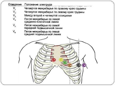 Возможность проведения ЭКГ при различных болезнях