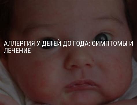 Возможные причины одноглазого подмигивания