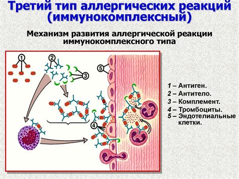 Возникновение инфекций и аллергических реакций