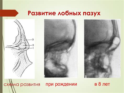 Возрастные особенности формирования лобных пазух