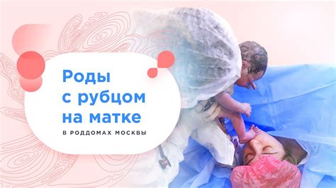 Вопросы, требующие выполнения ПКС с рубцом на матке