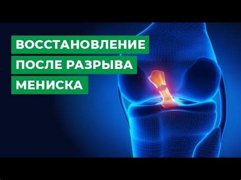 Восстановление после разрыва мениска: процессы и сроки