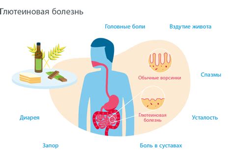 Вред для здоровья: аллергия и выделение формальдегида