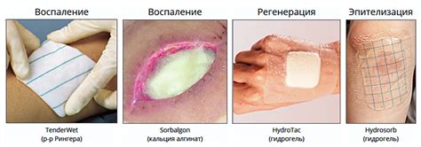 Время заживления раны