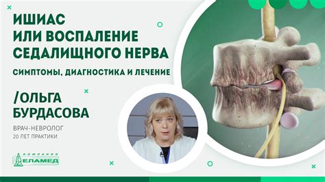 Вызывают ли уколы повреждение седалищного нерва?