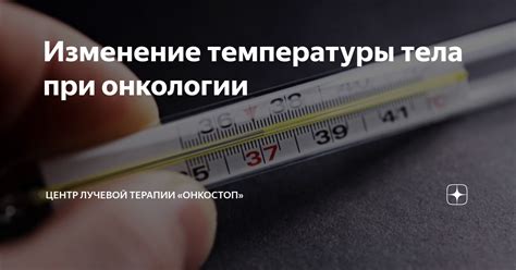 Действия при повышении температуры во время лучевой терапии