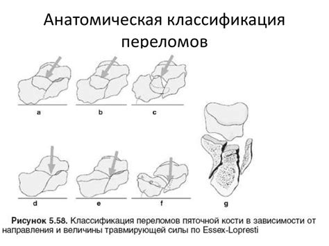 Диагностика перелома