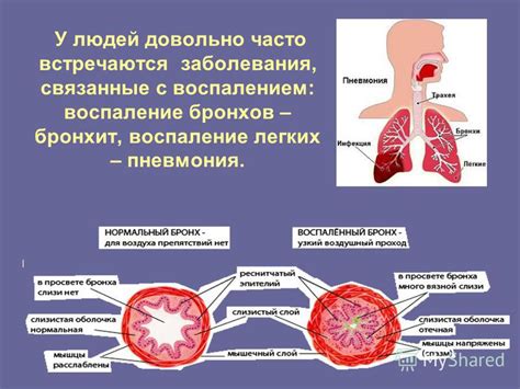 Заболевания глаз и дыхательной системы