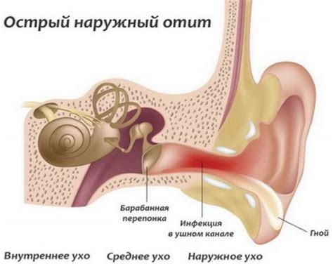 Зачем капать ухо при температуре?