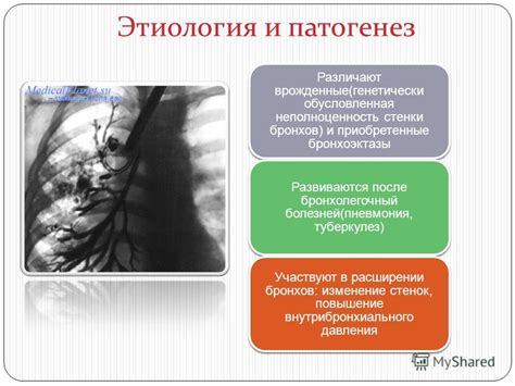 Изменение размеров бронхов