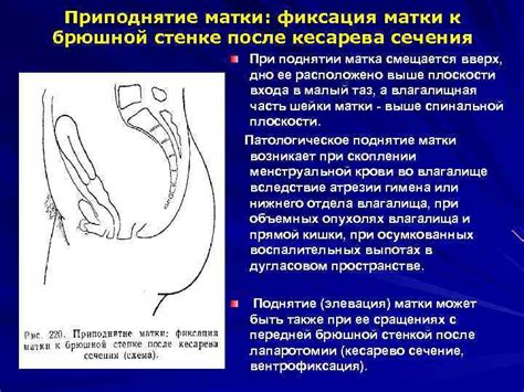 Изменения во влагалище после полового акта