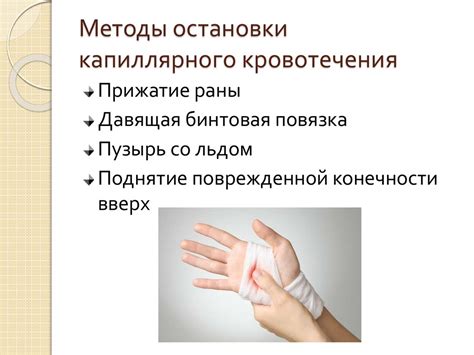 Инновационные методы предотвращения кровотечения