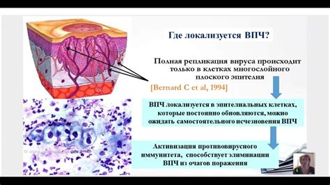 Исчезновение ВПЧ без лечения: реальность или миф?