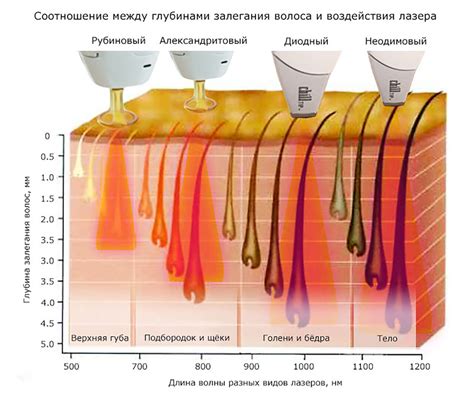 Какая частота использования скраба после лазерной эпиляции оптимальна