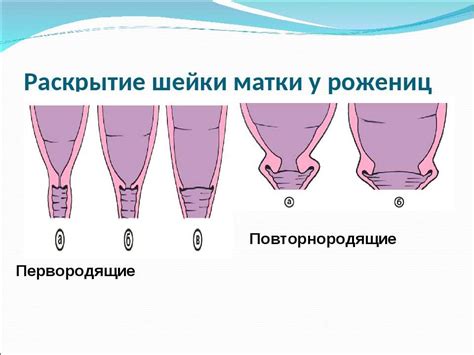 Какие симптомы могут ожидаться с шейкой 2 см на 39 неделе