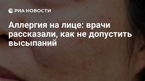 Как быстрее вылечить сыпь от аллергии у взрослого?