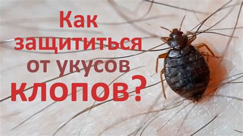 Как защититься от укусов клопов?