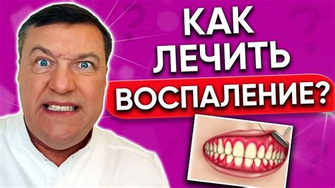 Как лечить стоматит