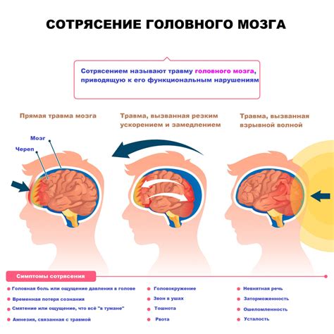 Как предотвратить повторное сотрясение мозга