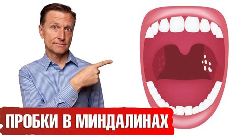 Как предотвратить появление пробок