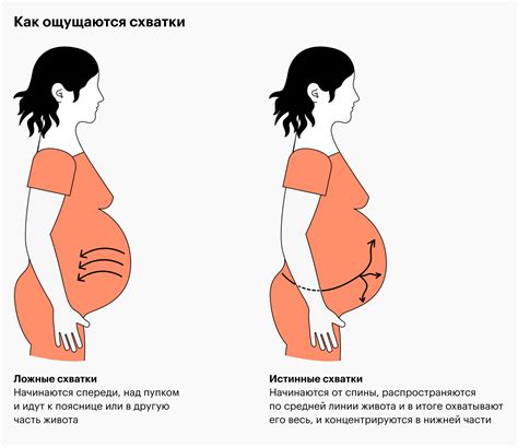 Как проводятся тренировочные схватки