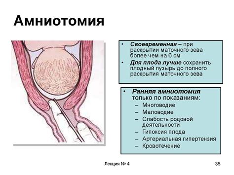 Как прокол пузыря может повлиять на начало схваток