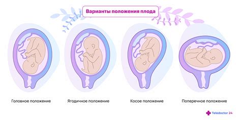 Когда происходит опускание плода