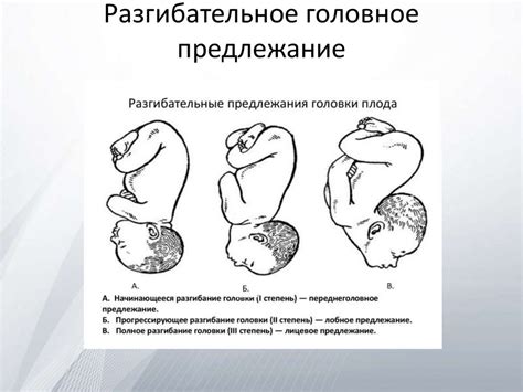 Методы определения положения головки плода