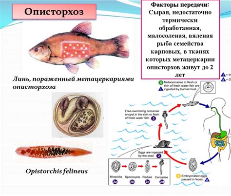 Минусы травления описторхоза