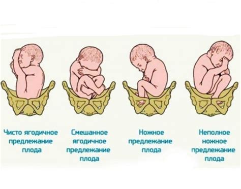 Наследственность и причины водянки яичек у новорожденных