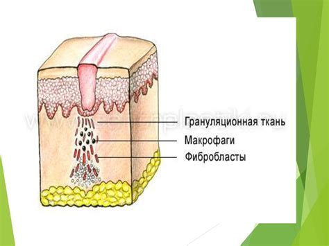 Образование рубца