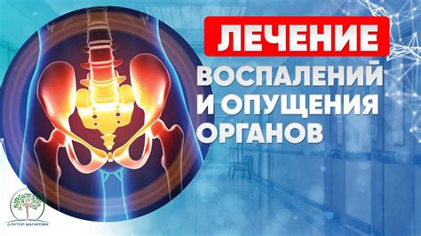 Определение опущения органов