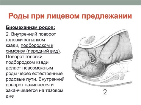 Определение положения головки плода в тазу матери