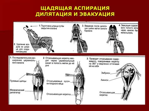 Основные правила восстановления после вакуумной аспирации