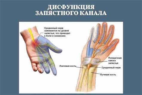 Основные признаки защемления нерва