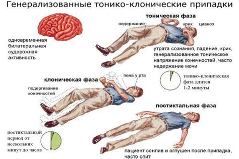 Основные симптомы и проявления судорог