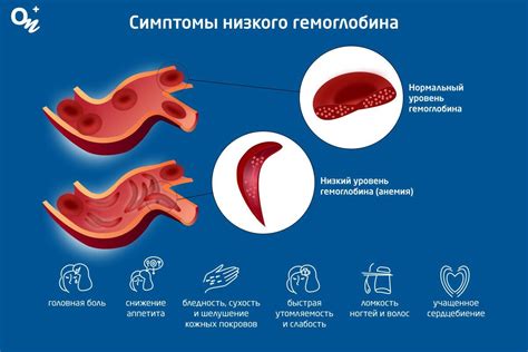 Основные симптомы низкого уровня гемоглобина