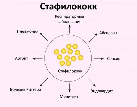 Основные симптомы стафилококка золотистого