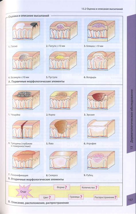 Периоды кожных высыпаний