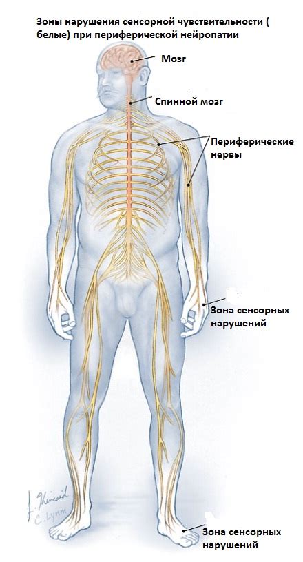 Периферическая нейропатия